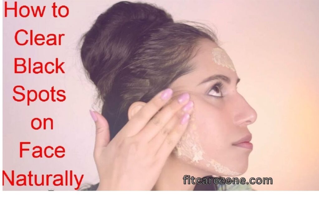 #DarkSpotsRemoval
#HyperpigmentationTreatment
#NaturalSkincareAtHome
#SkinBrighteningNaturally
#FitCareZone


